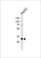 Proteasome activator complex subunit 2 antibody, MBS9208266, MyBioSource, Western Blot image 
