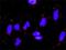 Laminin Subunit Gamma 1 antibody, H00003915-M03, Novus Biologicals, Proximity Ligation Assay image 