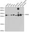 Phosphomannomutase 2 antibody, GTX64726, GeneTex, Western Blot image 