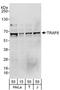 TNF Receptor Associated Factor 6 antibody, A303-803A, Bethyl Labs, Western Blot image 