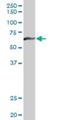 Myotubularin 1 antibody, H00004534-D01P, Novus Biologicals, Western Blot image 