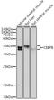 CCAAT Enhancer Binding Protein Beta antibody, GTX64382, GeneTex, Western Blot image 