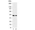 Kruppel Like Factor 5 antibody, R30989, NSJ Bioreagents, Western Blot image 