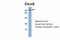 Chloride Voltage-Gated Channel 5 antibody, NBP1-69123, Novus Biologicals, Western Blot image 