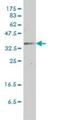 Gap Junction Protein Beta 3 antibody, H00002707-M01, Novus Biologicals, Western Blot image 