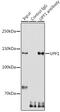 UPF1 RNA Helicase And ATPase antibody, GTX16390, GeneTex, Immunoprecipitation image 