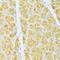 Fms Related Tyrosine Kinase 3 antibody, LS-C747536, Lifespan Biosciences, Immunohistochemistry frozen image 