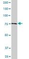 NADH:Ubiquinone Oxidoreductase Core Subunit S1 antibody, H00004719-B01P, Novus Biologicals, Western Blot image 