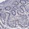 Phosphorylase Kinase Regulatory Subunit Alpha 1 antibody, HPA001081, Atlas Antibodies, Immunohistochemistry paraffin image 