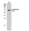 Calcium/Calmodulin Dependent Protein Kinase II Beta antibody, STJ90439, St John