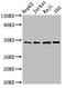 Eukaryotic Translation Initiation Factor 4A2 antibody, CSB-PA00384A0Rb, Cusabio, Western Blot image 