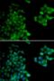 Proteasome Subunit Beta 10 antibody, LS-C346083, Lifespan Biosciences, Immunofluorescence image 