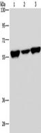 Apoptosis Inhibitor 5 antibody, TA322480, Origene, Western Blot image 