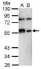 Kruppel Like Factor 12 antibody, GTX108840, GeneTex, Western Blot image 