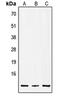 Insulin antibody, MBS822274, MyBioSource, Western Blot image 