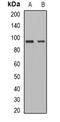 ADAM Metallopeptidase Domain 15 antibody, abx225010, Abbexa, Western Blot image 