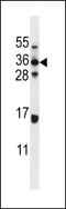 ELOVL Fatty Acid Elongase 5 antibody, LS-C167738, Lifespan Biosciences, Western Blot image 