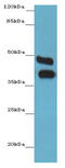 Carbonic Anhydrase 12 antibody, LS-B13795, Lifespan Biosciences, Western Blot image 