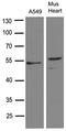 Transforming Growth Factor Beta 2 antibody, LS-C796587, Lifespan Biosciences, Western Blot image 