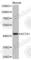 Actin Alpha 1, Skeletal Muscle antibody, A2478, ABclonal Technology, Western Blot image 