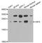 Core-Binding Factor Subunit Beta antibody, A5305, ABclonal Technology, Western Blot image 