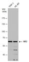 Malic Enzyme 2 antibody, GTX130673, GeneTex, Western Blot image 