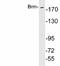 SWI/SNF Related, Matrix Associated, Actin Dependent Regulator Of Chromatin, Subfamily A, Member 2 antibody, A01888-1, Boster Biological Technology, Western Blot image 