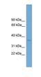 Zinc Finger Protein 444 antibody, orb324695, Biorbyt, Western Blot image 