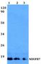 NADH:Ubiquinone Oxidoreductase Subunit B7 antibody, A10231, Boster Biological Technology, Western Blot image 