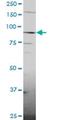 Mitogen-activated protein kinase kinase kinase kinase 1 antibody, H00011184-A01, Novus Biologicals, Western Blot image 