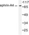 Ephrin A4 antibody, LS-C176007, Lifespan Biosciences, Western Blot image 