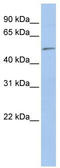 Eukaryotic Translation Initiation Factor 5 antibody, TA337602, Origene, Western Blot image 