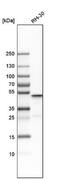 Acyl-CoA Thioesterase 9 antibody, NBP1-90275, Novus Biologicals, Western Blot image 