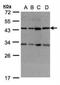 DnaJ Heat Shock Protein Family (Hsp40) Member C17 antibody, NBP1-32472, Novus Biologicals, Western Blot image 