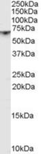 P21 (RAC1) Activated Kinase 1 antibody, NB100-41389, Novus Biologicals, Western Blot image 