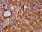 Histidine ammonia-lyase antibody, LS-C670320, Lifespan Biosciences, Immunohistochemistry paraffin image 