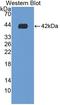 GDNF Family Receptor Alpha 1 antibody, LS-C374978, Lifespan Biosciences, Western Blot image 