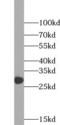 Calcium release-activated calcium channel protein 1 antibody, FNab06002, FineTest, Western Blot image 