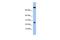 Zinc Finger SWIM-Type Containing 3 antibody, GTX45506, GeneTex, Western Blot image 