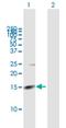 Rhomboid Like 2 antibody, H00054933-B01P, Novus Biologicals, Western Blot image 