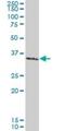 SMAD Family Member 3 antibody, H00004088-M02, Novus Biologicals, Western Blot image 