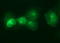 Interleukin 6 Receptor antibody, LS-C797753, Lifespan Biosciences, Immunofluorescence image 