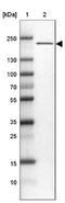 Proteasome Activator Subunit 4 antibody, NBP2-32575, Novus Biologicals, Western Blot image 