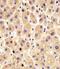 Glycogen phosphorylase, liver form antibody, M06317, Boster Biological Technology, Immunohistochemistry paraffin image 