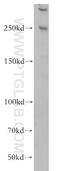 Centrosomal Protein 250 antibody, 14498-1-AP, Proteintech Group, Western Blot image 