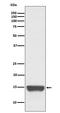 TNF Receptor Superfamily Member 12A antibody, M06261, Boster Biological Technology, Western Blot image 