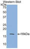 Activin A Receptor Type 2A antibody, LS-C292630, Lifespan Biosciences, Western Blot image 