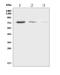 NDC80 Kinetochore Complex Component antibody, A01731-2, Boster Biological Technology, Western Blot image 