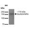 Glutamate Ionotropic Receptor NMDA Type Subunit 2A antibody, MA5-27692, Invitrogen Antibodies, Western Blot image 