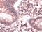 FAS antibody, PA5-32336, Invitrogen Antibodies, Immunohistochemistry frozen image 